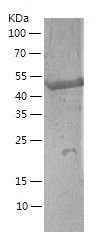 Recombinant Human ANGPTL2