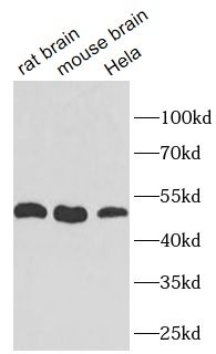 GSDME antibody
