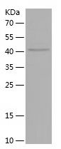 Recombinant Human NEFL