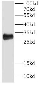 CRYBB1 antibody