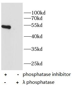 Phospho-p53 (S46) antibody