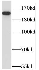 NPHP4 antibody