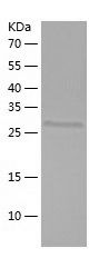 Recombinant Mouse Apoe