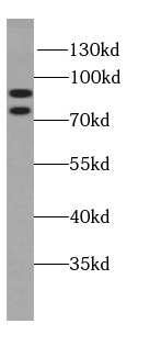 SPART antibody