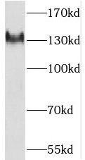PKP4 antibody