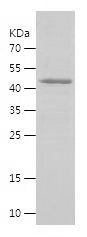 Recombinant Human SNAI1