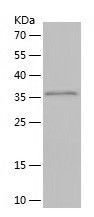 Recombinant Human HIGD1A