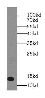 NUTF2 antibody