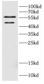 CALU antibody