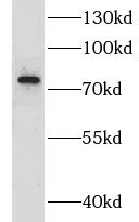 GRK2 antibody