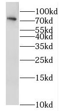 RAB11FIP1 antibody