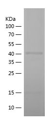 Recombinant Human NFKB2
