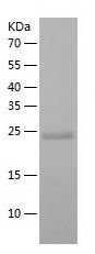 Recombinant Human DGCR6L