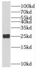 NTMT1 antibody