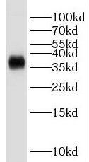 GNB2 antibody