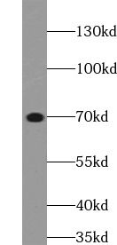 ELN antibody