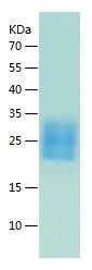 Recombinant Mouse ICOS