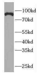 GGCX antibody