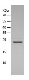 Recombinant Human USP8