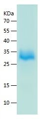 Recombinant Mouse BTNL6