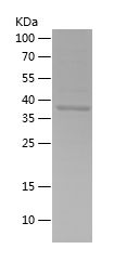 Recombinant Human AKT2