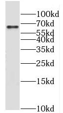MLXIPL antibody