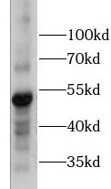 Phospho-Camk2a (T286) antibody