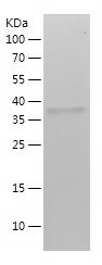 Recombinant Human KRT15