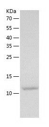 Recombinant Human BAZ2B