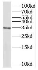 PPP6C antibody