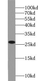 NQO2 antibody