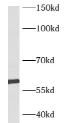B3GLCT antibody