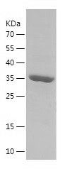 Recombinant Human PDLIM1
