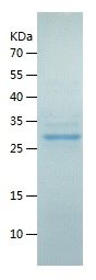Recombinant Human ITGAM