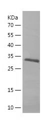 Recombinant Human INVS