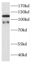 DNAJC6 antibody