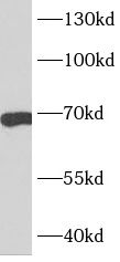 CDC6 antibody