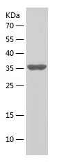 Recombinant Human VDAC2
