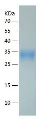 Recombinant Rat angpt2