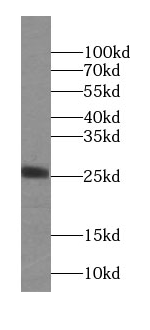 NAA11 antibody