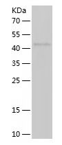 Recombinant Human BBS7