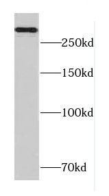 CACNA1B antibody