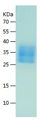Recombinant Mouse TGFBR2