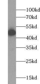ABHD2 antibody