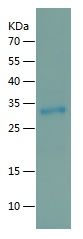 Recombinant Human RAB3GAP1