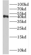 RSPO3 antibody