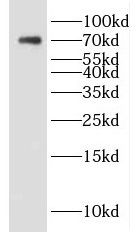 DTX4 antibody