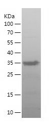Recombinant Human SPN