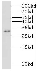 NUBP2 antibody