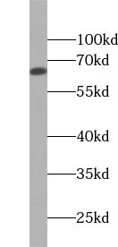 ZNF654 antibody